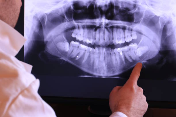 Best Emergency Dentist for Knocked-Out Tooth in Vista Center, NJ