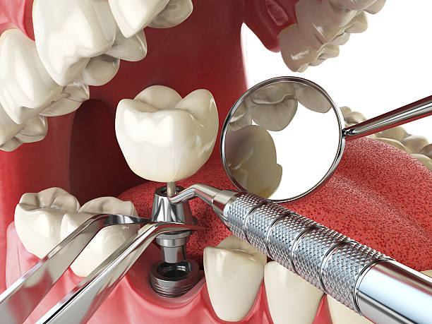 Best Emergency Root Canal Treatment in Vista Center, NJ